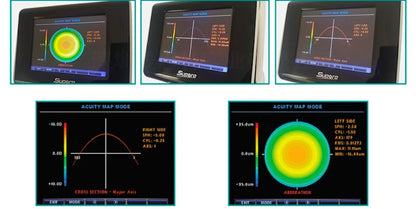 RMK-700 Autoref/Keratometer